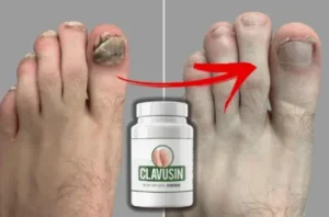 Clavusin Customer Reviews